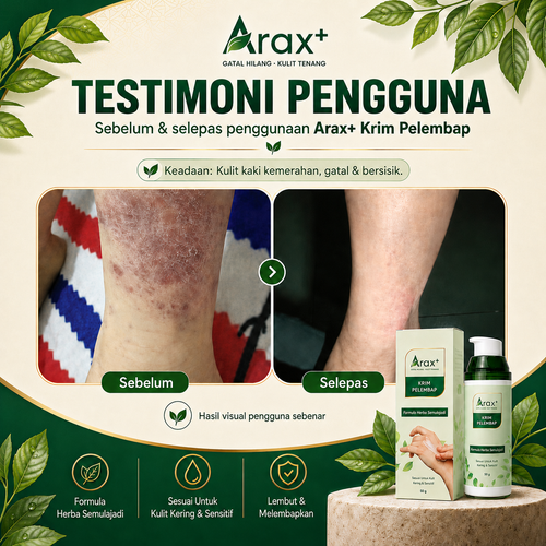 Arax+ Krim 【Kulit Gatal/Kering/Ekzema-Prone/Sensitif/Kurap】