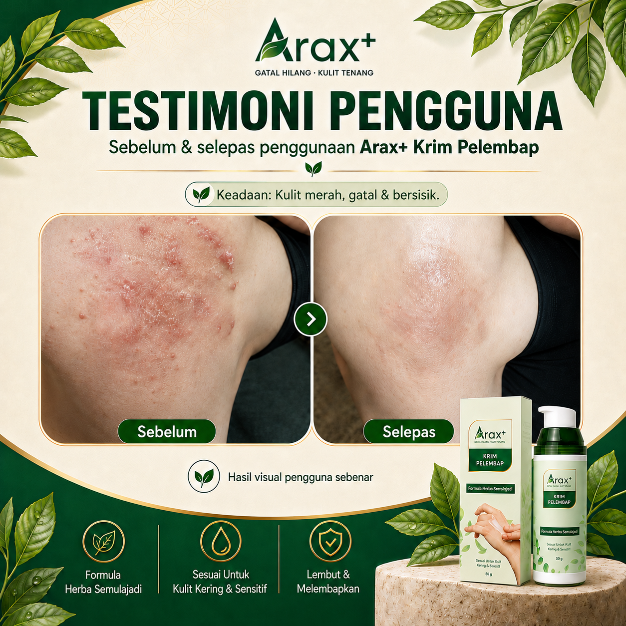 Arax+ Krim 【Kulit Gatal/Kering/Ekzema-Prone/Sensitif/Kurap】