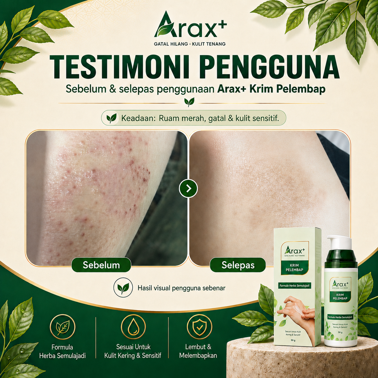 Arax+ Krim 【Kulit Gatal/Kering/Ekzema-Prone/Sensitif/Kurap】