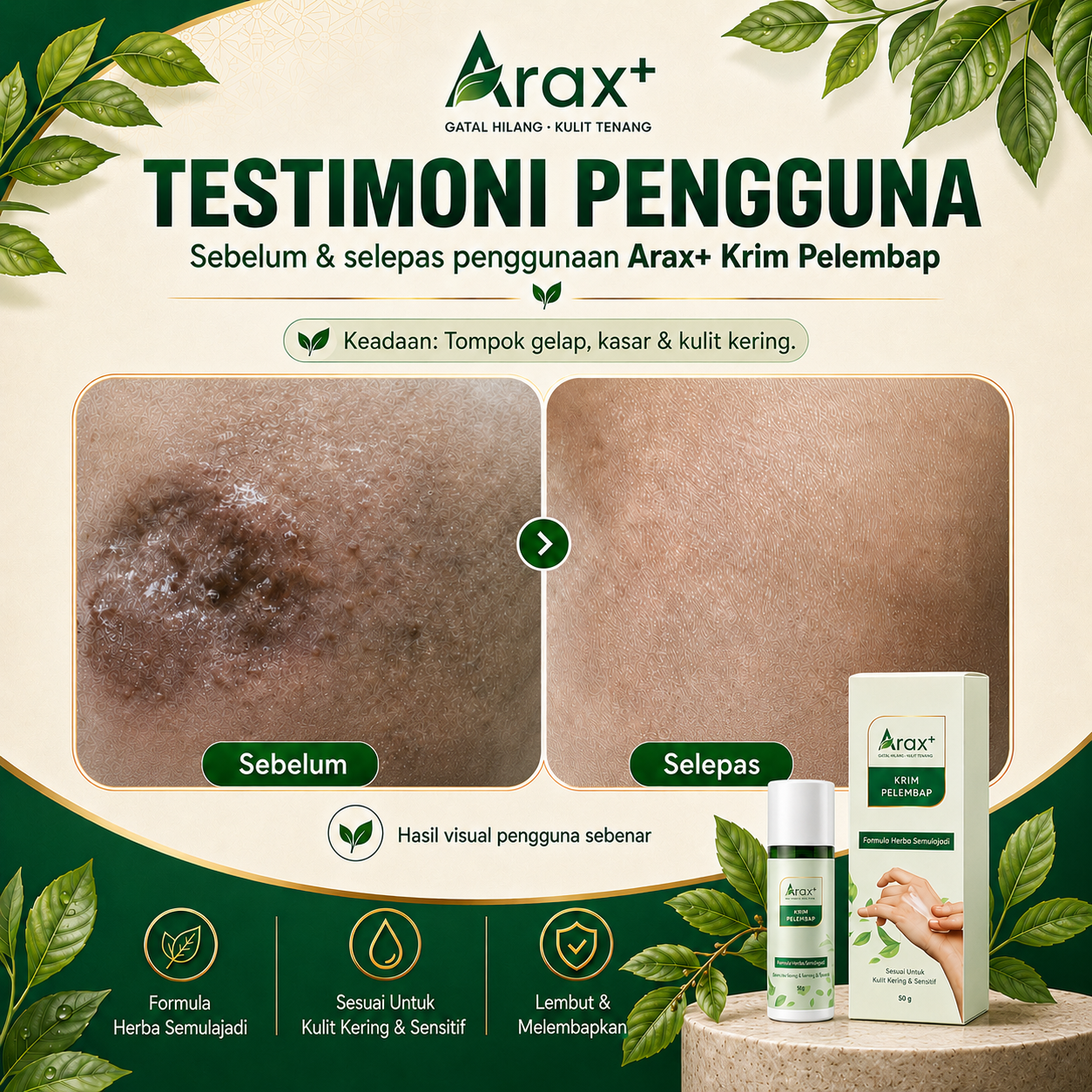 Arax+ Krim 【Kulit Gatal/Kering/Ekzema-Prone/Sensitif/Kurap】